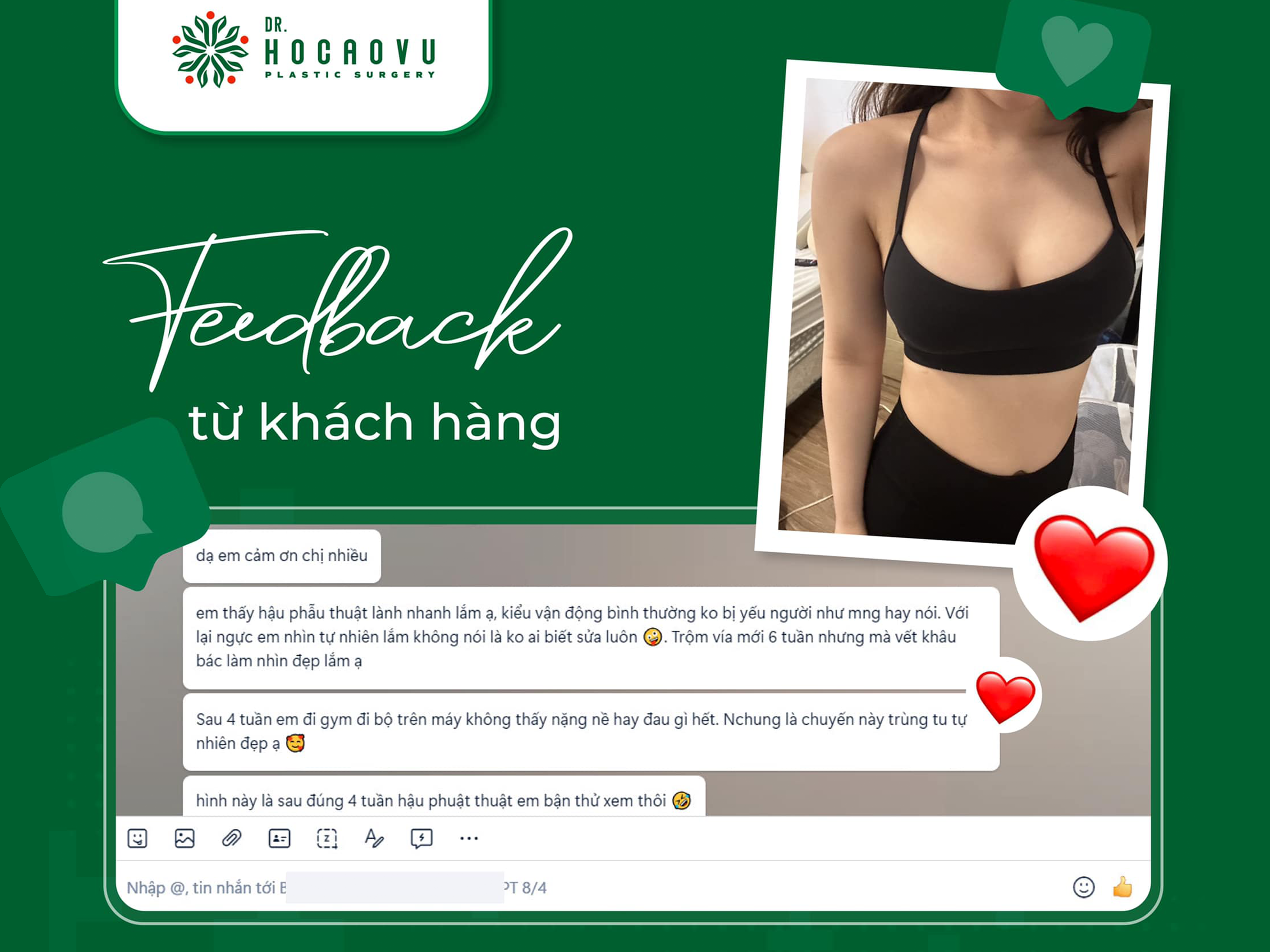 Nâng ngực bao lâu thì hết căng cứng? Mốc thời gian hồi phục theo từng giai đoạn