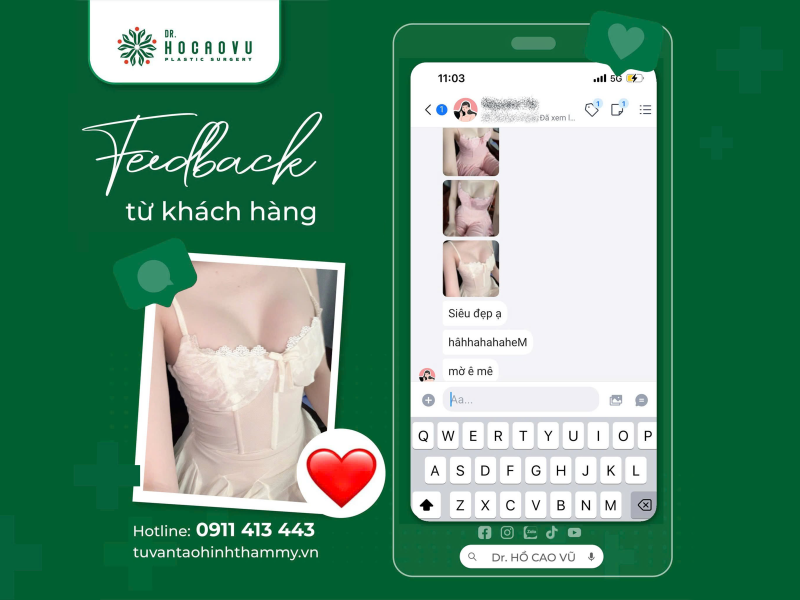 Nâng ngực size 285cc có to không? Ai hợp size 285 — bác sĩ tư vấn theo khung người